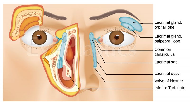 Site of  congenital NLDO